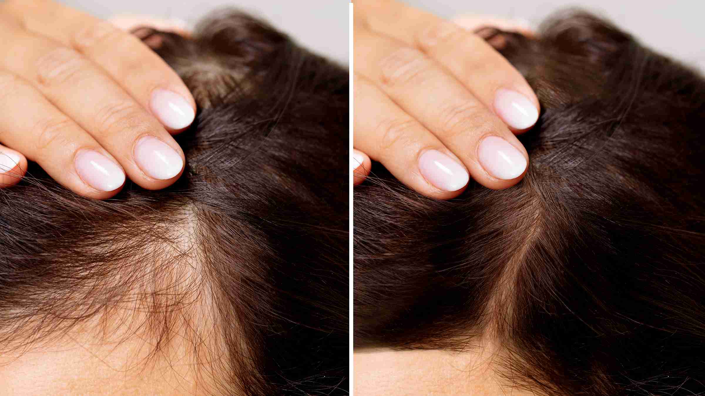 How To Avoid Hair Loss In Tamil | BideNews