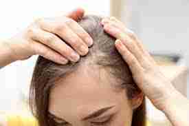 How to Overcome Hair Loss in Tamil 